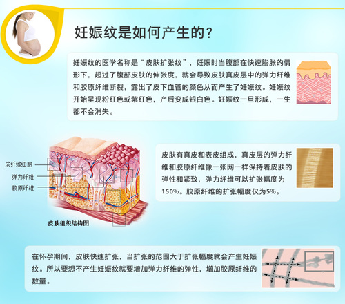 3款高知名度妊娠纹霜大对比