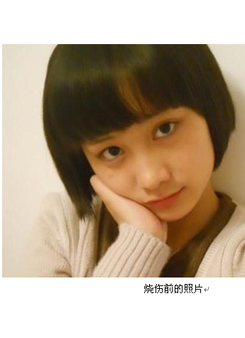 伊美尔公益救助 公益慈爱在你我心中