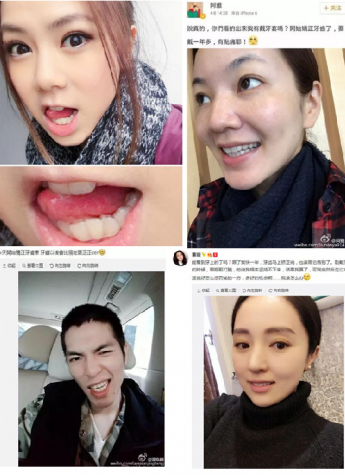 时代天使隐形矫治让你的颜值悦人悦己