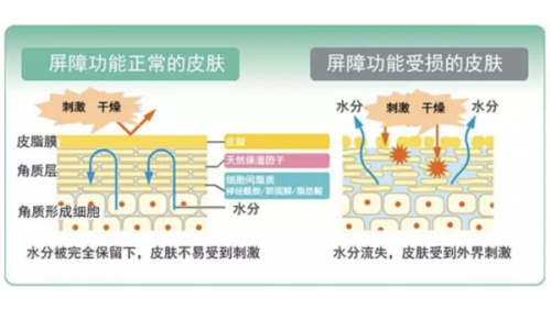 肌膚敏感問題多發(fā)？法國美帕無防腐劑面膜為你保駕護航！