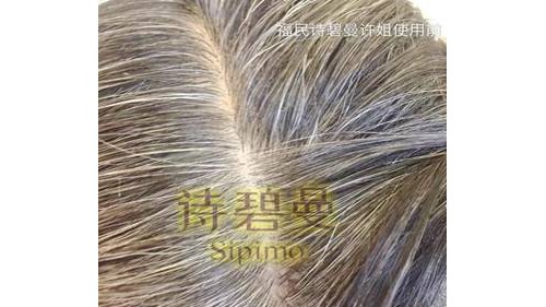 面对自然衰老我感到无助，这样的诗碧曼，我不想错过