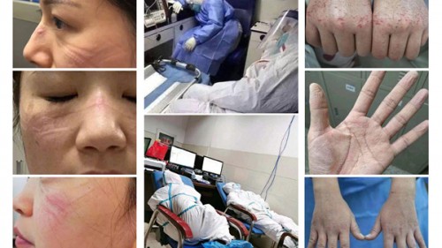 思妍麗三地捐贈物資過千萬，助力戰(zhàn)疫共渡難關(guān)！