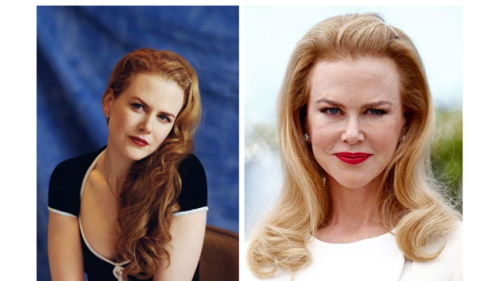 涂抹、注射还是口服？解锁玻尿酸的正确补充方式